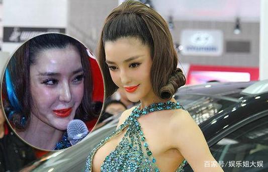 女星整容失敗引發(fā)社會關(guān)注，審美扭曲下的悲劇，女星整容失敗引發(fā)社會熱議，審美扭曲背后的悲劇