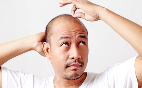 如何改善脫發(fā)問題，全方位解決方案，全方位解決方案，改善脫發(fā)問題的方法與技巧
