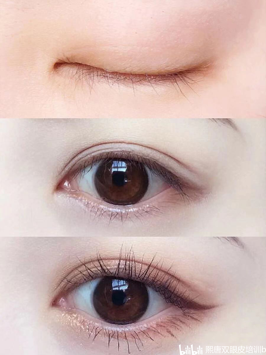 自己練出雙眼皮永久