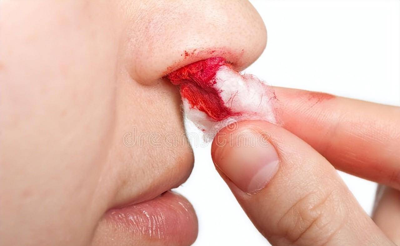突然一個鼻孔出血