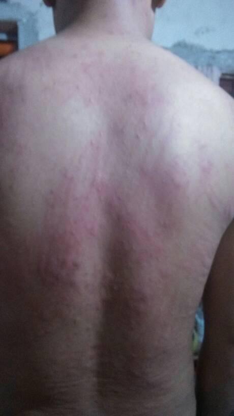 無緣無故長疙瘩又紅又癢，原因解析與應對策略，無緣無故長紅癢疙瘩，原因解析及應對方法