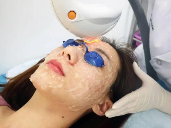 光子嫩膚做一次有效嗎？深入了解光子嫩膚的效果與過程，光子嫩膚效果與過程解析，做一次是否有效？